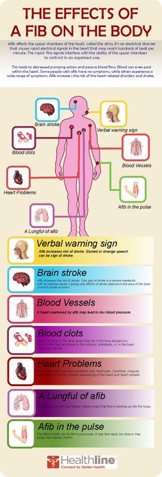 the effects of a fib on the body info poster - health and medicine information