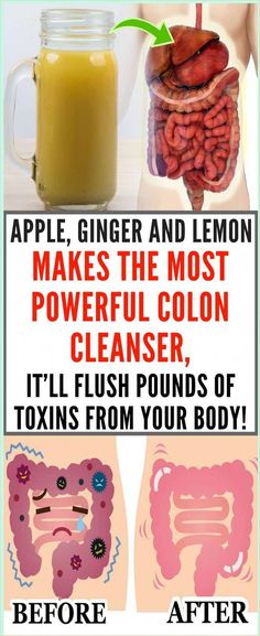 Colon Flush, Detox Cleanse Water, Turmeric Curcumin Benefits, Ginger And Lemon, Turmeric Capsules, Colon Cleanse Recipe, Turmeric Vitamins, Fresh Turmeric