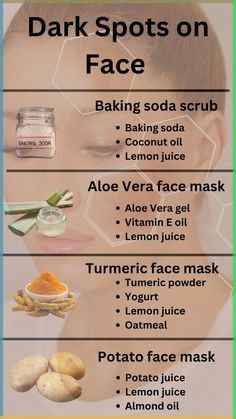 Combat dark spots naturally with these simple DIY remedies. Use a baking soda scrub made from baking soda, coconut oil, and lemon juice to exfoliate and brighten your skin. Apply an aloe vera face mask combining aloe vera gel, vitamin E oil, and lemon juice for soothing hydration. A turmeric face mask of turmeric powder, yogurt, and lemon juice can help reduce pigmentation, while a potato face mask made with potato juice, lemon juice, and almond oil may lighten dark spots over time. Turmeric For Acne Remedies, Baking Soda Coconut Oil Face Mask, Natural Remedies For Dark Spots On Face, How To Lighten Dark Spots On Face, Baking Soda Face Mask Dark Spots, Face Pigmentation Remedies, Dark Spots On Face Remedies, Face Mask For Dark Spots, Turmeric For Face