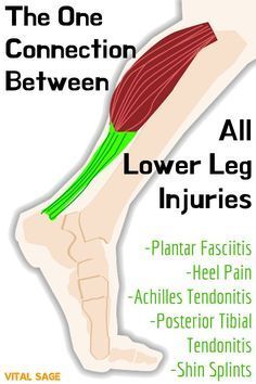 the foot and lower leg are labeled in this poster, which is part of an advertisement for