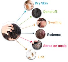 Scalp Follicitis, Dry Patches On Scalp, Scabs On Scalp, Scalp Scabs, Scalp Bumps, Massage Routine