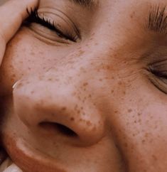 a woman with freckles on her face is talking on the phone