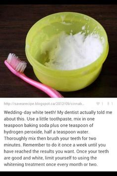 Instant results for whiter teeth! I wish I had done this before my wedding! Get Whiter Teeth, Teeth Whitening Remedies, Teeth Whitening Diy, Diy Teething, Whiter Teeth, Best Teeth Whitening, Natural Teeth Whitening, Natural Teeth, Teeth Care