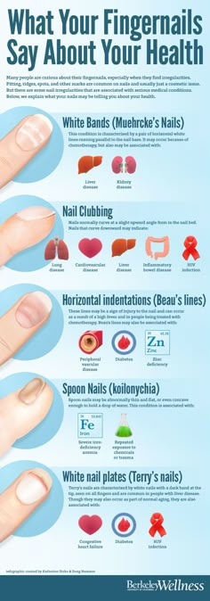 What Your Fingernails Say About Your Health Common Sense Evaluation Fingernail Health, Tongue Health, Avocado Smoothie, Mental Training, Nail Health, Health Info, Health Facts, Medical Conditions, Health Remedies