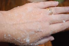 Home Remedy for Dry Chapped Hands. This REALLY works! madefrompinterest.net Dry Hands Remedy, Chapped Hands, Dry Skin Remedies, Diy Kosmetik, Beauty Remedies, Dry Skin Care, Beauty Recipe, Diy Skin