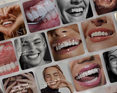 50 Teeth Whitening Social Media Posts for Aesthetic Clinics - Fully Customizable & Ready to Use Boost your clinic's Instagram presence with our premium collection of 50 fully customizable teeth whitening social media posts designed for aesthetic and dental clinics. These eye-catching posts are perfect for promoting your teeth whitening services, educating clients about the procedure, and showcasing before-and-after results to increase bookings and engagement. When you purchase, you'll receive a Teeth Whitening Business Posts, Teeth Whitening Business Aesthetic, Dental Instagram Posts, Dental Social Media Posts, Before And After Template, Teeth Whitening Business, Dental Aesthetic, Dental Photos, Dental Social Media