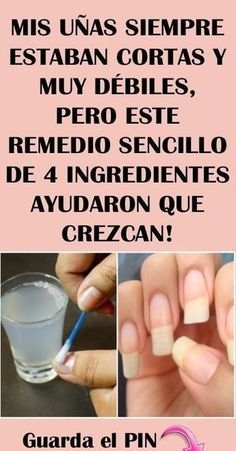 Hot Sauce Recipes, Nail Fungus, Nail Manicure, Sauce Recipes, Beauty Nails