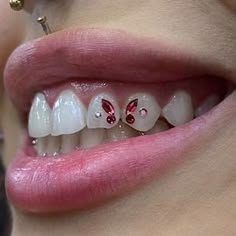 a close up of a person's teeth with white and red decorations on them