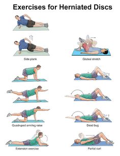 Exercise for Herniated disc/ Exeercise for disc prolapse/exercise fo slipped disc. //// ท่าออกกำลังสำหรับหมอนรองกระดูกทับเส้น Prolapse Exercises, Bolesti Chrbta, Bulging Disc, Neck Exercises, Spine Health