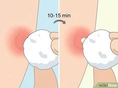 How to Instantly Get Rid of a Pimple (Cotton Ball Popping Method)
#skin care routine #skincare product #bubble skincare Ingrown Pimple, Pimples Remove Tips, Hide Pimples With Makeup, Tips For Pimples, Cheek Pimples, Pimples Skin Care, How To Hide Pimples, Mask For Pimples, Zit Remedy