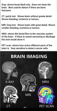 the brain and its functions are shown in black and white, with text below it