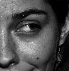 black and white photograph of a woman with freckles on her face