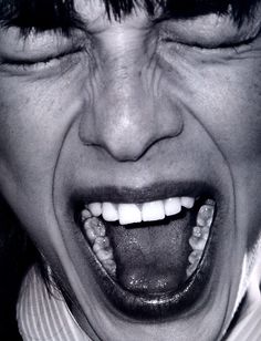 a close up of a person with his mouth open and teeth missing from tooth decay