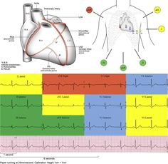 the diagram shows different types of heart valves