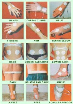 Tens Electrode Placement, Tens Unit Placement, Tens Therapy, K Tape, Tens And Units, Tens Machine, Tens Unit, Tens Ems