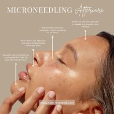 Microneedling Benefits, Microneedling Aesthetic, Micro Needling Before And After, Esthetician Instagram Post Ideas, Cosmetics Advertising, Esthetician Inspiration, Beauty Treatments Skin Care, Creative Advertising Photography