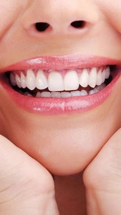 #HowIsOralCareDone #WhatIsOralCareProcedure Whiten Teeth At Home, Loose Tooth, Whiten Teeth, Natural Teeth Whitening, Oral Health Care, White Teeth, Tooth Decay