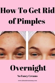 What Causes Pimples, Painful Pimple