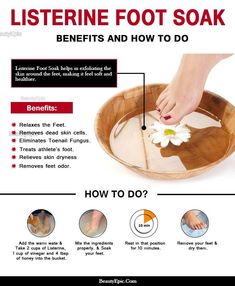 Home Foot Soak, Pedicure Soak, Listerine Foot Soak, Foot Soak Recipe, Diy Pedicure, Pedicure At Home, Foot Soak, Beauty Clinic, Foot Spa