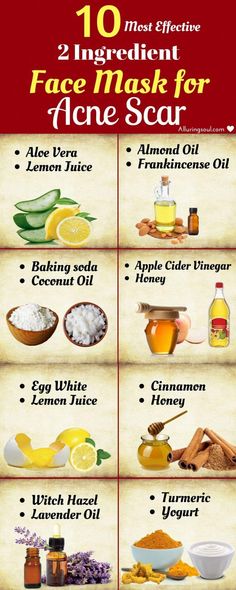 These Face mask for acne scars will help you to get clear skin and lightens the stubborn acne marks and also provide nourishment to your skin. Face Masks For Acne, Masks For Acne, Face Mask For Acne, Acne Scar Mask, Mask For Acne, Skin Care Routine For 20s, Home Remedies For Acne, Acne Scar, Scar Removal