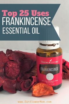 Frankensense Oil Benefits, Frankincense Essential Oil Young Living, Frankincense Uses, Frankincense Essential Oil Benefits, Frankincense Essential Oil Uses, Young Living Frankincense, Oils For Headaches, Savvy Minerals, Essential Oils For Pain