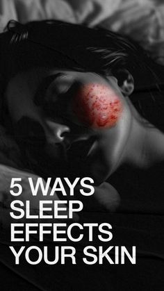 In a world where skincare routines are increasingly complex and the beauty industry is bursting with new products, there's a timeless secret to maintaining radiant skin that doesn't cost a dime—good sleep. It’s called beauty sleep for a reason; it’s nature's most powerful beauty treatment, working wonders on wrinkles, acne, brightness, and dryness. Here are five ways that sleep can significantly enhance the health and appearance of your skin: Sleep Supplements, Tips Skincare, Skincare Routines, Sleep Tips, Sleep Issues, Beauty Sleep, Cant Sleep, Natural Sleep, Care Skin