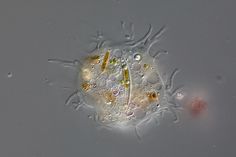 an animal cell under microscope glass with water droplets on the bottom and yellow, white, and red cells below it