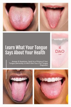 Your Tongue &amp; Its Role in Acupuncture, Chinese Herbal Medicine, and Your Sleepless Nights Caring Information &amp; Considerations Although we can learn a lot about you from your tongue, it can’t tell us everything. A review of your tongue is just one of several things an acupuncturist would do during an appointment Vegan Probiotics, Healthy Heart Tips, Chinese Herbal Medicine, Tongue Health, Muscles In Your Body, Deep Wrinkles, Nail Health, Natural Remedy, Diy Health