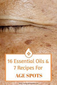 Age Spots Essential Oils, Essential Oils For Age Spots, Get Rid Of Age Spots, Age Spots On Face, Essential Oils For Face, Brown Spots On Face, Spots On Face, Baking Soda Shampoo