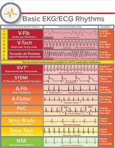 Room Basic, Paramedic School, Nursing Student Tips, Medical Student Study