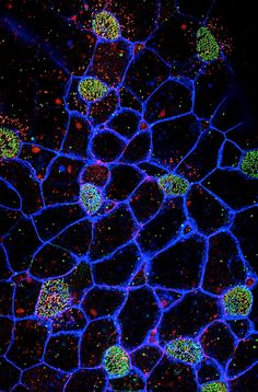 the structure of an animal cell is shown in blue and green colors, with bright spots on it