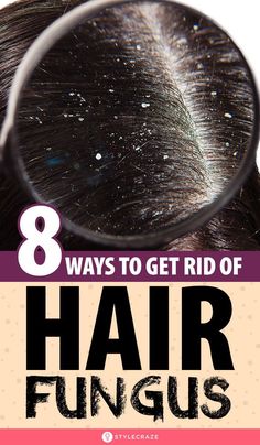 Smelly Scalp, Scalp Fungus, Smelly Hair, Ways To Grow Hair, Natural Dandruff Remedy, Fungal Infection Skin, Dandruff Remedy, Washing Your Hair, Fungal Infection