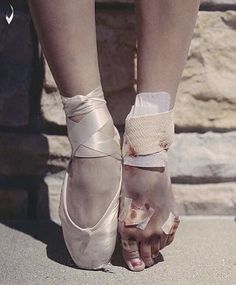 a ballerina's feet with bandages on them