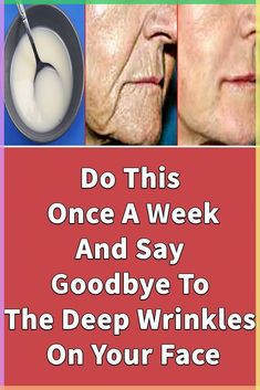 Most of us believe that to Remove Deep Wrinkles On The Face natural methods are not effective like the aesthetic methods. But the fact is that using the natu... Wrinkles Remedies Face, Sagging Cheeks, Saggy Neck, Wrinkle Remedies, Wrinkle Free Skin, Skin Care Wrinkles, Glow Skin, Saggy Skin, Face Wrinkles