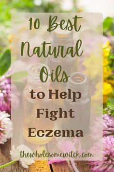 Eczema can be a constant battle. It's always nice to have some go to natural remedies at your disposal! Click through for 10 of the best carrier and essential oils to help treat eczema and dry skin naturally. #naturalliving #essentialoils #holisticliving #naturalremedies #eczemaremedies Oils For Sinus, Dry Skin Remedies, Skin Natural Remedies, Essential Oils For Skin, Skin Remedies, Best Essential Oils, Best Oils, Life Tips, Beauty And Lifestyle