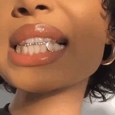 a woman with braces on her teeth