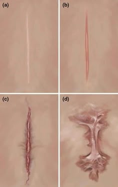 four pictures showing different stages of hair growth