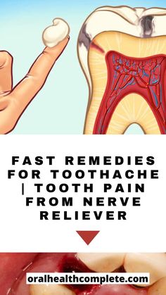 Fast Remedies For Toothache | Tooth Pain From Nerve Reliever Cavity Pain, Cavity Remedy, Toothache Relief, Nerve Pain Remedies, Tooth Nerve