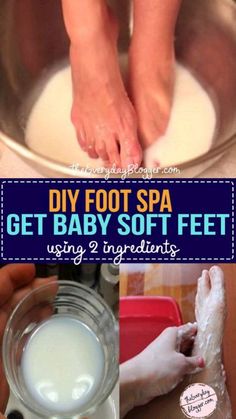 Cracked Heels, Diy Spa, Natural Beauty Tips