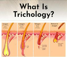 Skin Diseases And Disorders, Trichologist Aesthetic, Trichology Hair, Hair Anatomy, Hair Theory, Hair Medicine, Hair Diseases, Diseases And Disorders, Hair Growth Methods