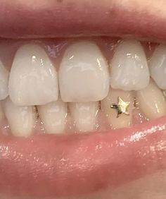 a smile with white teeth and gold stars on it