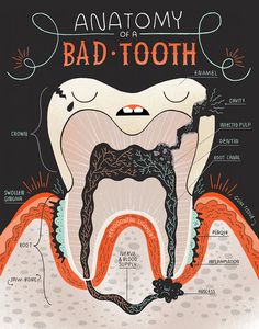 Teeth Anatomy, Dental Hygiene School, Teeth Art, Dental Anatomy, Dental Fun, Bad Teeth, Nice Teeth