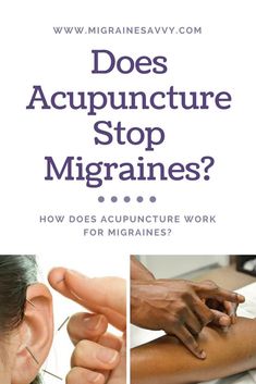 Acupuncture for migraines, can it help? Studies show it is as effective as preventive drug therapy for migraine and it’s safe, long-lasting and cost-effective. @migrainesavvy #migrainerelief #migraines #acupuncture Migraine Facts, Migraine Tips, Migraine Hangover, Acupressure Headache, Migraine Awareness, Montessori Trays, Shiatsu Massage Acupressure