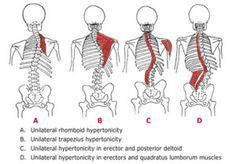 Muscle Anatomy, Massage Techniques, Anatomy And Physiology, Reflexology