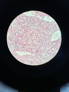 an image of a section of the stomach