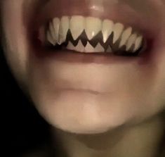 a close up of a person's mouth with teeth