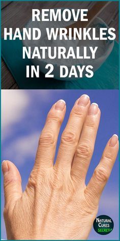 Remove Wrinkles From Hands, Blond Cenușiu, Home Remedies For Wrinkles, Wrinkles Hands, Wrinkle Remedies, Face Wrinkles, Beauty Remedies, Skin Care Remedies