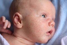 a baby with freckled hair laying on a blue blanket looking up at the camera