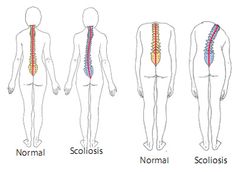 Hunchback Exercises, Spine Art, Healthy Spine, Robotic Arm, Biomedical Science, School Health