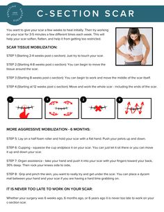 the instructions for how to use c - section scar